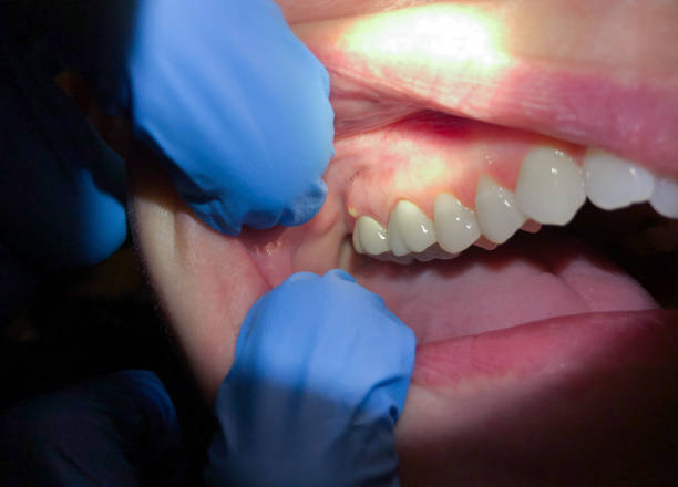 Best Emergency Dental Services Near Me  in Angier, NC